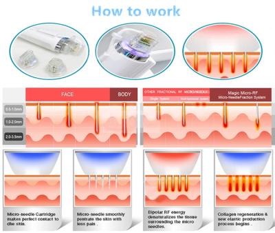 China Portable 10600nm Co2 Fractional Laser Machine For Skin Resurfacing And Wrinkle Removal for sale