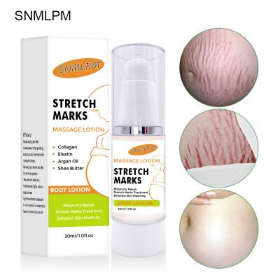 China Organic Stretch Mark Remove Cream Skin Repair Anti Stretch Mark Skin Revitalizer For Pregnancy Repair Scar Marks Stretch Mark Cream Natural Quantity for sale