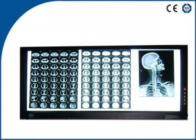 Chine Visionneuse de film ultra mince de radiographie du triple LED, contrôle indépendant de commutateur de bouton rotatoire à vendre