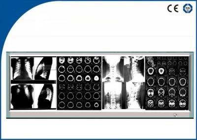 Κίνα Σταθερή φωτεινότητα ιατρική ταινία Negatoscope, θεατής των οδηγήσεων ταινιών οθόνης τεσσάρων οδηγήσεων προς πώληση