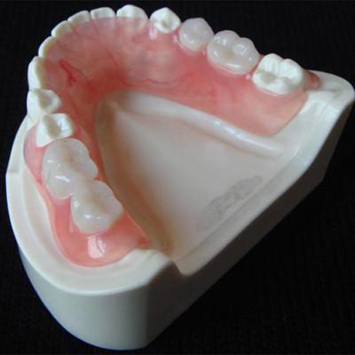 China Porcelain-Fused-to-Metal (PFM) Crowns - China Dental Lab for sale