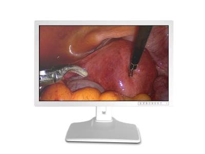 China HDMI VGA Medical Display 32 Inch 4k Monitor for sale