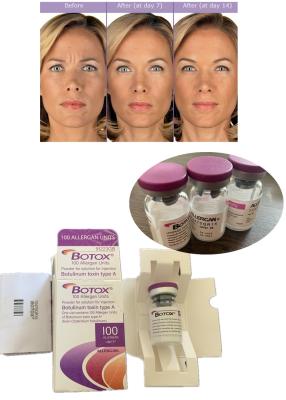 China Anti Wrinkle  Botulinum Toxin Allergan 100IU 150iu Xeomin' Na for sale