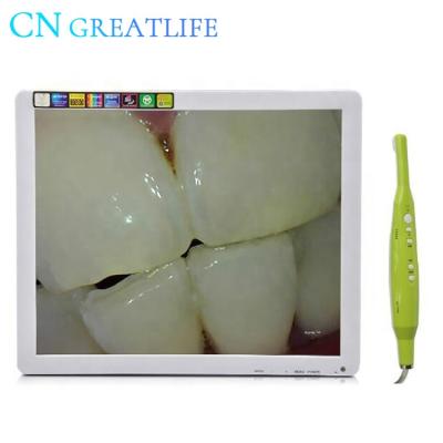 China Metal Type Dental 17 Inch Unit Auto Focus USB Camera PIP Camera Oral Intraoral Intraoral Monitor Intraoral Camera for sale