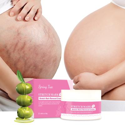 China Private Label 100% Effective Stretch Mark Removal Nourishing Creams Stretch Marks In One Week Natural Asiaticoside Stretch Mark Cream for sale