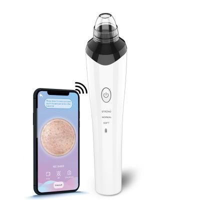 China New Pore Acne Treatment 2021 Electric Facial Acne Remover WIFI HD Vacuum Blackhead Remover With Camera for sale