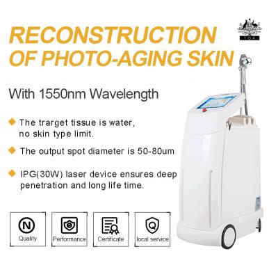 China Erbium Glass Fractional Laser Resurfacing For Cheek Wrinkle Removal , Acne Scars Removal 1550nm Laser for sale