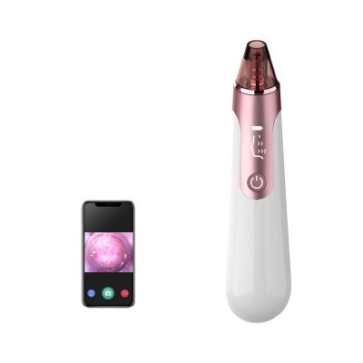 China Black and Whitehead Electronic Blackhead Remover Obvious Facial Removal Massager With Camera Vacuum Black Waterproof White USB Pink for sale