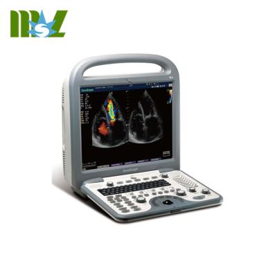 China S8 Portable Medical Ultrasound Machine 4d Spatial Compound Imaging for sale