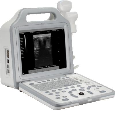 China Cheap Price MSLPU50 Full Digital Radiation Portable Ultrasound Machine For Pregnancy for sale