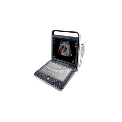 China Cheapest Metal S9 Sonoscape Portable Color Doppler Digital Ultrasound Machine For Hospital for sale