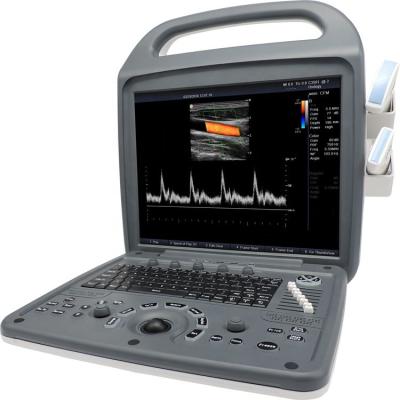 China MSLCU59 Mobile High Quality Full-digital Portable Color Doppler Ultrasound Machine for sale