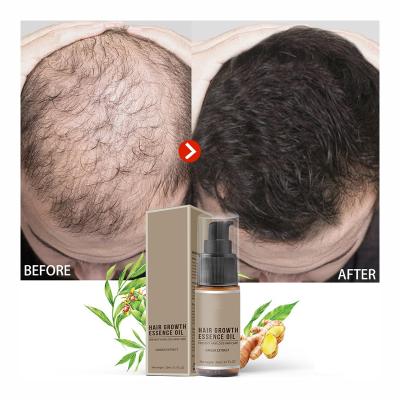 China Custom Natural Ginger Nutrient Germinal Hair Care Private Label Loss Prevention Serum Drops Biotin Hair Growth Oil Spray for sale