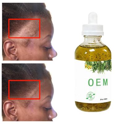 China Custom Hair Loss Prevention OEM Hair Tonic Smoothing Repairing Anti Loss Regrowth Scalp Elixir Hair Growth Oil Serum for sale