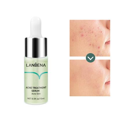 China LANBENA Oilgopeptide Acne Treatment Acne Treatment Face Whitening and Acne Remove Dark Spots Serum for sale