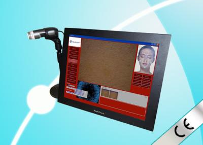 China Nubway Touchscreen Skin Analyzer Machine For Skin Sensitiveness And Age Test for sale