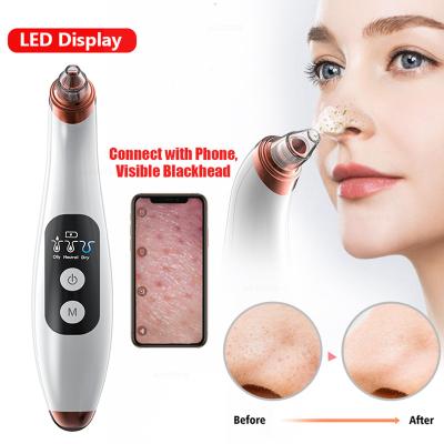 China Acne Treatment LED Display 6 Suction Heads Black Head Treatment Acne Remover Vacuum Head Black Exfoliate Facial Vacuum Blackhead Remover for sale