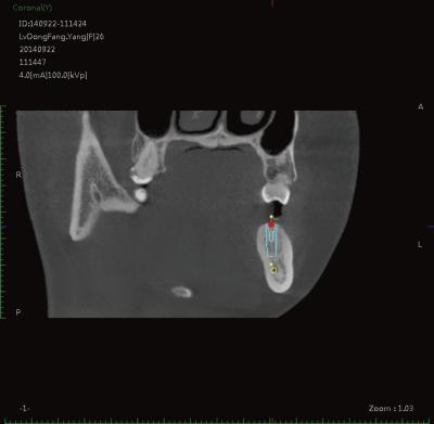 China Größe der medizinische Klinik-zahnmedizinische Darstellungs-System-0.125mm 0.25mm 0.075mm Voxel zu verkaufen