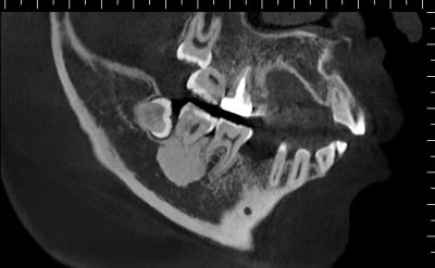 China Hires3D Tandkegelstraal gegevens verwerkte tomografie cbct 3 in 1 Systeem Te koop