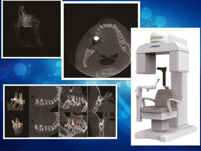 China Ultra Low Dose Level Dental CT Scanner With Radiation Protection for sale