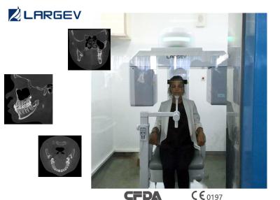 China Zahnmedizinische Darstellungssysteme LargeV Hires3D mit besserem - Darstellungsfortschrittssystem und Metallartefaktabbau zu verkaufen