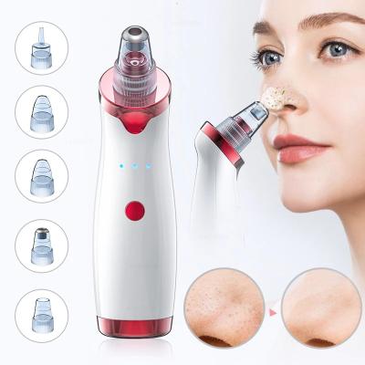 China Portable Power Tool Kit Remover Removing Blackheads Vacuum Acne Treatment Derma Suction With Heater for sale