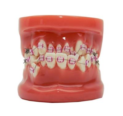 China Durable High Quality Red Ceramic Brackets Orthodontics Dental Model for sale