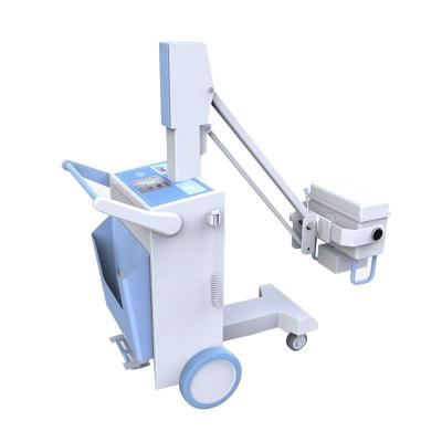 China Medical X Ray Equipment High Frequency Digital Portable X-Ray Machine 900KJ Heat Capacity for sale