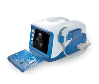 China Portable Doppler Medical Ultrasound Machine 10” High Resolution Monitor for sale