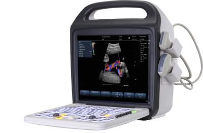 China 15'' LCD Screen Portable color Doppler ultrasound with stable image performance for sale