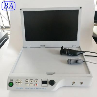 China Metal Professinal New Surgical Type CMOS Integrated Ear Nose Endoscopy for sale