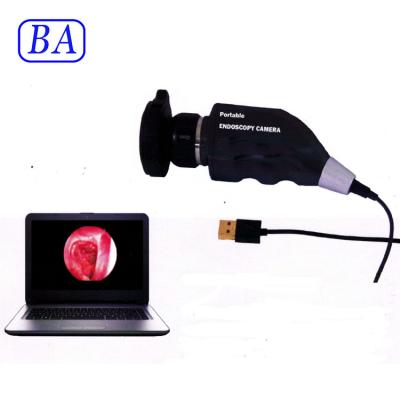 China New Type HD Usb Portable Ear Nose Surgery Medical Endoscope for sale