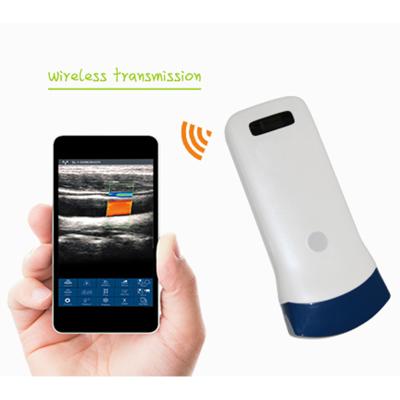 China Emergency Wireless Type Mini Ultrasound Scanning Machine For Pregnancy for sale