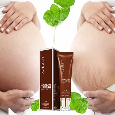 China Acne Treatment Organic Herbal Treatment Private Label TCM Skin Scar Stretch Deep Mark Removal Repair Cream Gel Ointment Acne Anti and Pregnancy for sale