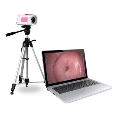 China SW-3301 Gynecology Colposcope Portable Laptop Digital Digital Colposcope Video Colposcope With Software for sale