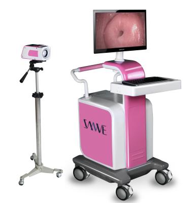 China Gynecology Inspection SW-3303 Digital Colposcope Digital Electronic Colposcope Visual Colposcope for sale