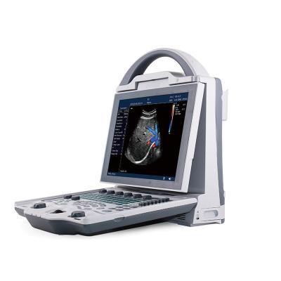 China Medical Hospital Diagnose Machine YS-L3 High Quality Portable Color Doppler Laptop Ultrasound Scanner for sale