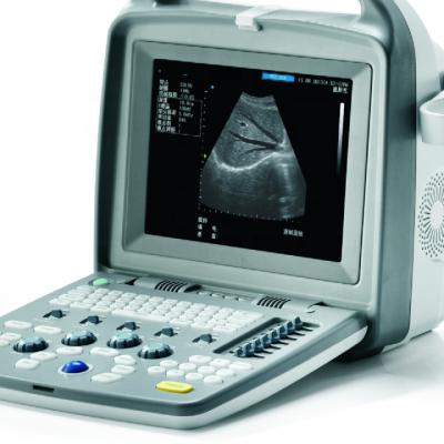 China CTS-5500 plastic portable black white ultrasound scanner machine similar to DP-20 mindray for sale