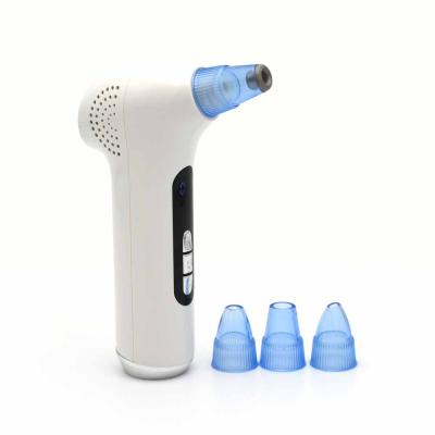 China Electric hot cold blackhead remover dropshipping hot cold electric vacuum acne treatment rise remover for sale