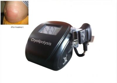 Κίνα παχιά κύτταρα παγώματος Cryolipolysis οθόνης αφής 8 ιντσών, λιποβόρος μηχανή 110V/60Hz προς πώληση