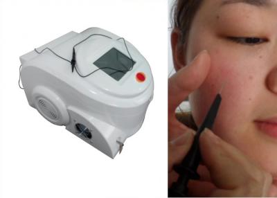 China Portable facial red spider veins removal machine , skin tag removal machine for sale