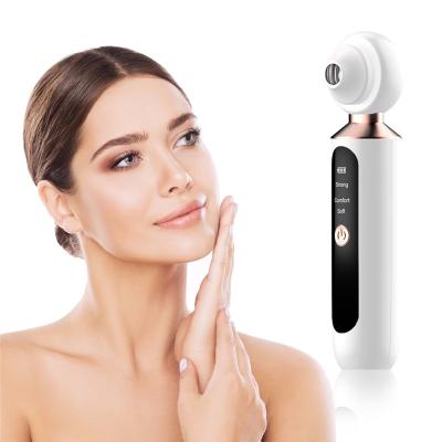 China Acne Treatment Pore Vacuum Blackhead Remover LED Blackhead Light Personal Care Beauty Tool Derma Suction Blackhead Remover for sale