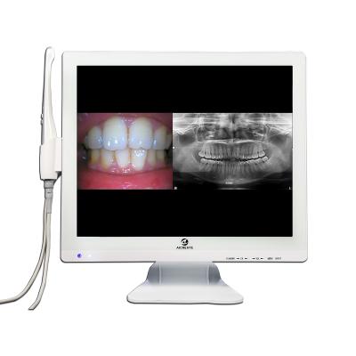 China Yes Digital Dental Camera 8MP Intraoral Image 10 LED Super Clear Light 17 Inch LCD Monitor Dentist Teeth Best Inspection Equipment for sale