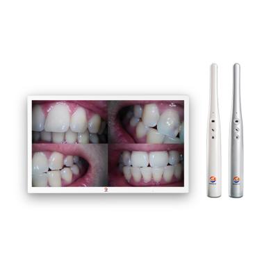 China Portable Dental Equipment Wireless Transfer A9S-X Wireless And Waterproof Dental Camera For Teeth Dental Equipment Wireless Intraoral Camera for sale