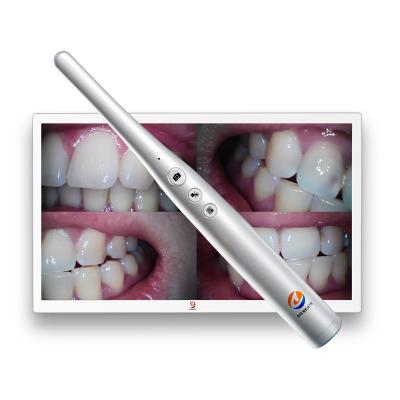 China Dental Equipment A9S-X Wireless Handheld Intraoral Endoscope Transfer Camera for sale