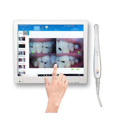 China Sector Intraoral Camera Dental Intra Supplies Dental Oral Camera With Screen Kids Dental Chair A6M-X USB Intraoral Camera for sale