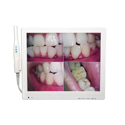 China Camara Dental Equipment Oral Dental Compound Instruments Metal Intraoral Camera A6S-X for sale