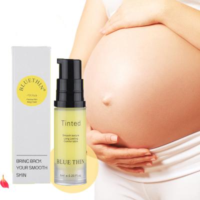 China Whitening Mark Cream Pregnancy Repair Scar Natural Soft Non-irritating Abdomen Stretch Loose Line Stretch Marks Cream Repair Cream for sale