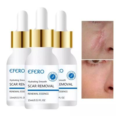 China Skin Revitalizer Efero Scar Remove Essence Acne Treatment Blackhead Removal Anti Acne Cream Oil Control Shrink Peeps Acne Face Care Whitening for sale