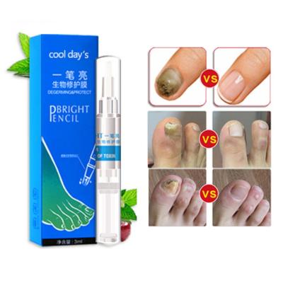 China Nail Fungus Repair Nail Treatment on Feet and Hand Disinfection Nail Fungal Oil Pen Manicure Treatment Tools for sale